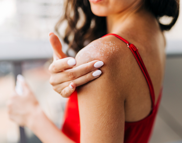 Scottature solari: rimedi e soluzioni per alleviare dolore e bruciore