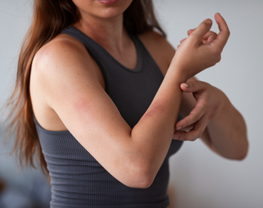 Infezioni Fungine: tutto sulle micosi più comuni